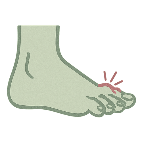 Hammer Toes