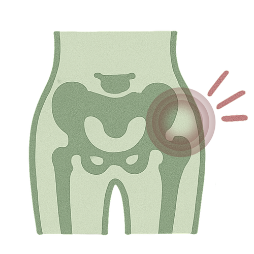 Hip Pain